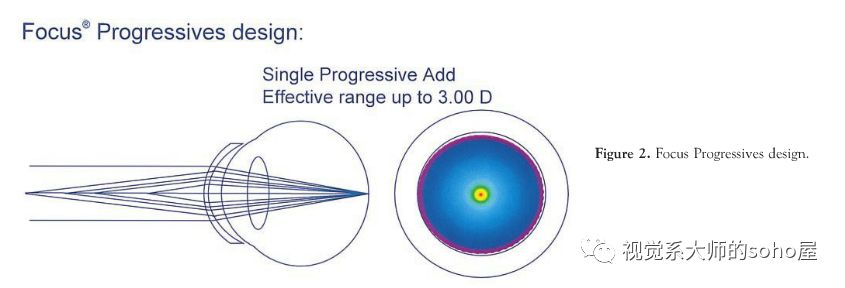 硬性隐形眼镜更适合超高度近视,高度近视最适合的透明隐形眼镜