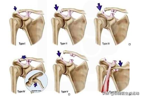 胳膊一动肩膀就咯噔咯噔响,胳膊一动关节就咔咔响筋还疼