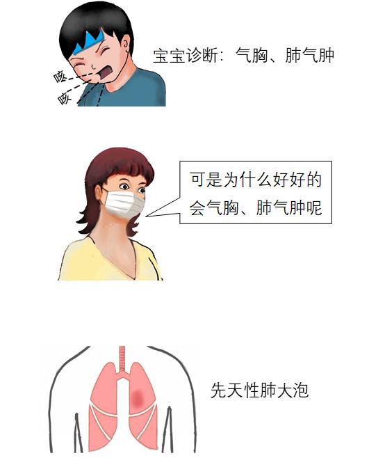 剧烈咳嗽呼吸困难上不来气,咳嗽多痰呼吸困难有哮鸣音