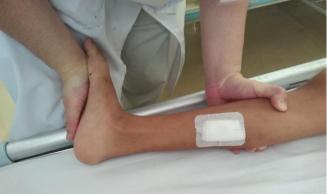 脑瘫踝关节术后康复,脑瘫完全康复