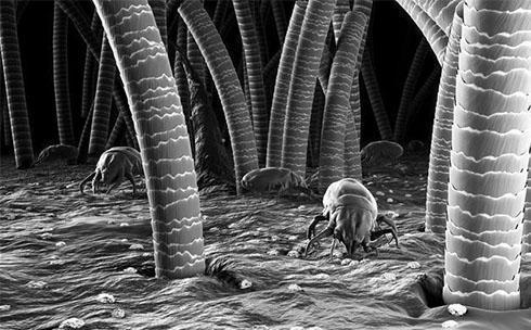 头皮屑是怎么产生的该怎么消除,头皮屑为什么多有什么办法解决