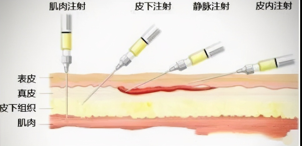 养殖户学习技巧,学习给羊打针技术