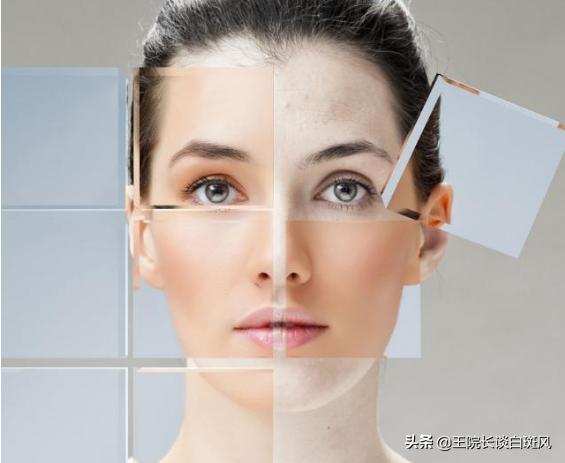 老年斑怎么避免以后少长,长了好多老年斑怎么办