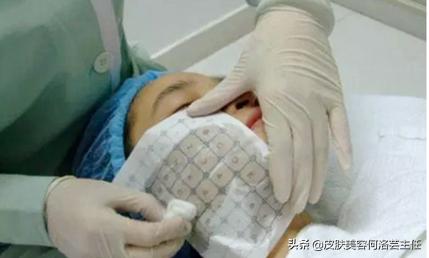 热玛吉操作时正确的手法,热玛吉医生操作时有技巧吗