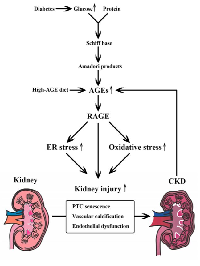 慢性肾脏疾病的饮食图谱,慢性肾病3期怎么治疗恢复