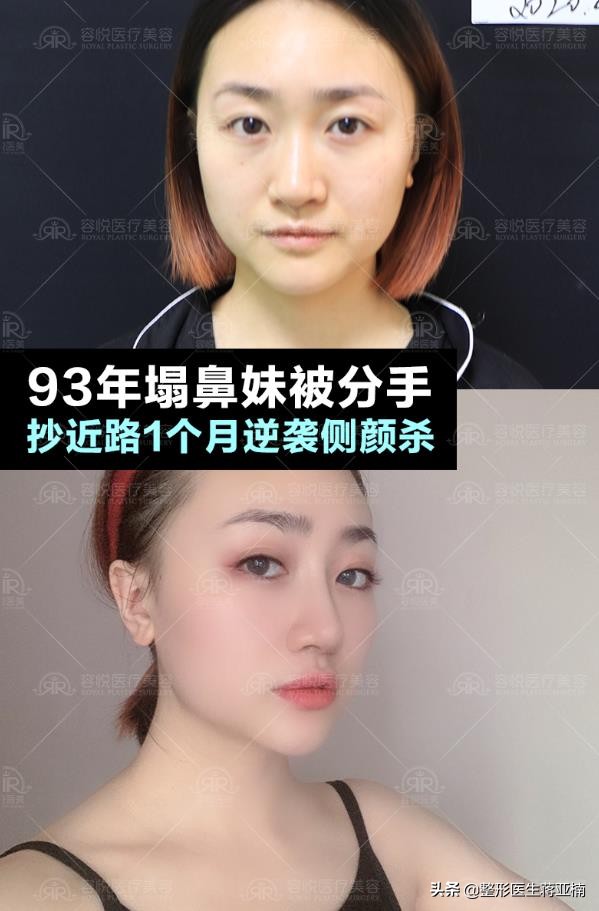 塌鼻妹逆袭,塌鼻妹