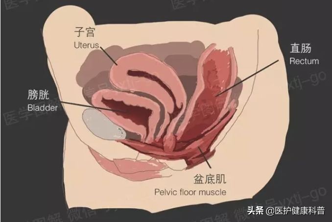 产后子宫脱垂盆底肌训练,产后修复远离漏尿