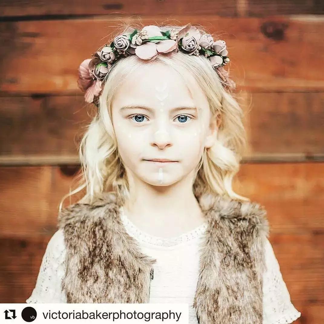 因为卫生棉条被截肢,女星因为卫生巾截肢