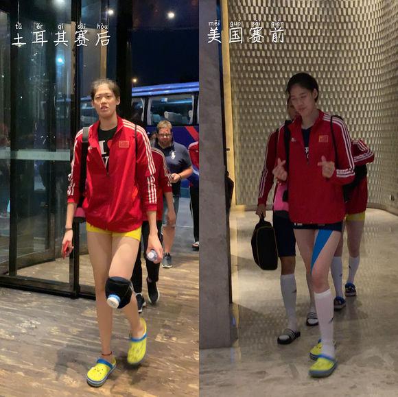 李盈莹打埃格努视频,李盈莹伤情最新消息