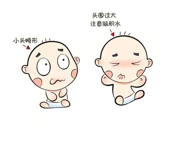 产检医生说胎儿头小,孕期医生说孩子头双顶径有点小