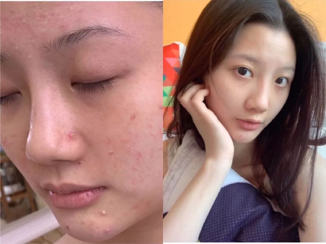 美白精华评测倩碧科颜氏sk2,美白淡斑精华skii