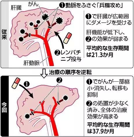肝癌新疗法获批国际iii期,世界首例治愈肝癌