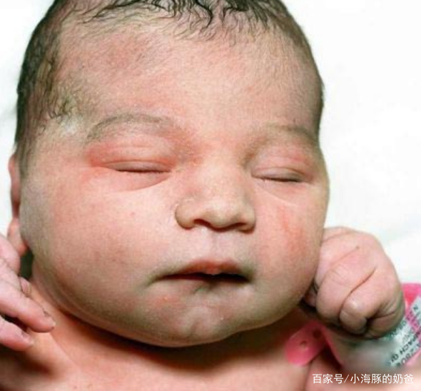 新生儿入睡困难最好的治疗方法,新生儿宝宝入睡困难的解决方法