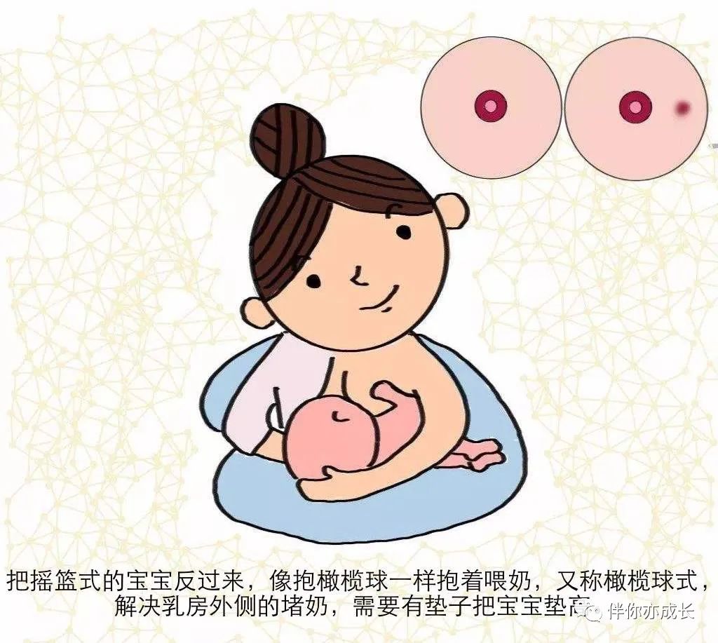 堵奶如何处理最有效,乳腺管不通奶堵怎么处理