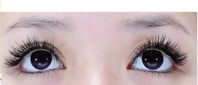 一块钱的红霉素眼膏,1-2块钱的红霉素眼膏长什么样