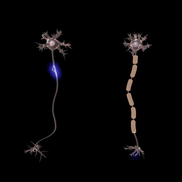 人类大脑如何超越人工智能,人类的出路在于将自身升级为神