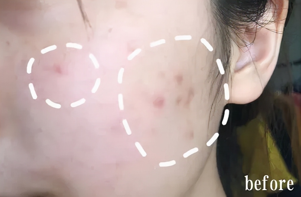 珀婷pertine除螨仪,珀婷除螨喷雾剂测评