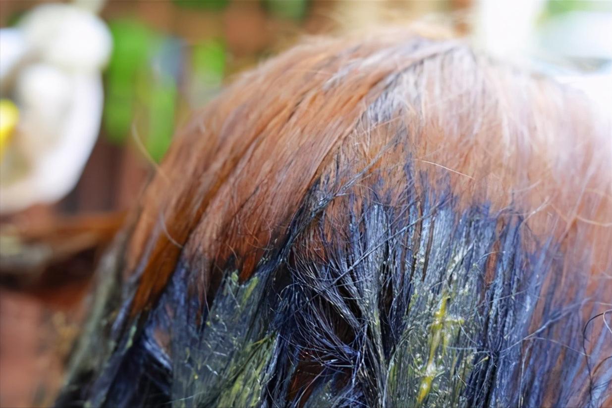 染发为什么会秃,染发会有毒吗