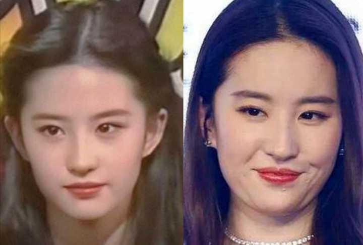 如何改善咬肌鹅蛋脸,咬肌变大脸发腮怎么改善