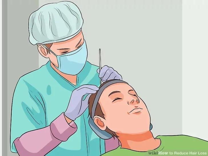 减少脱发的洗发水,脱发毛囊减少