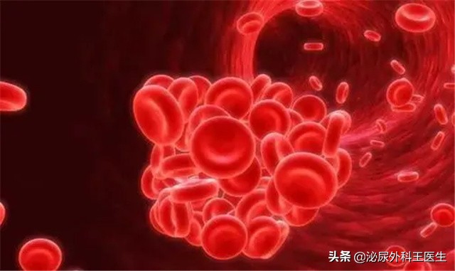 男性多吃什么补肾补精,男性吃什么补肾最好