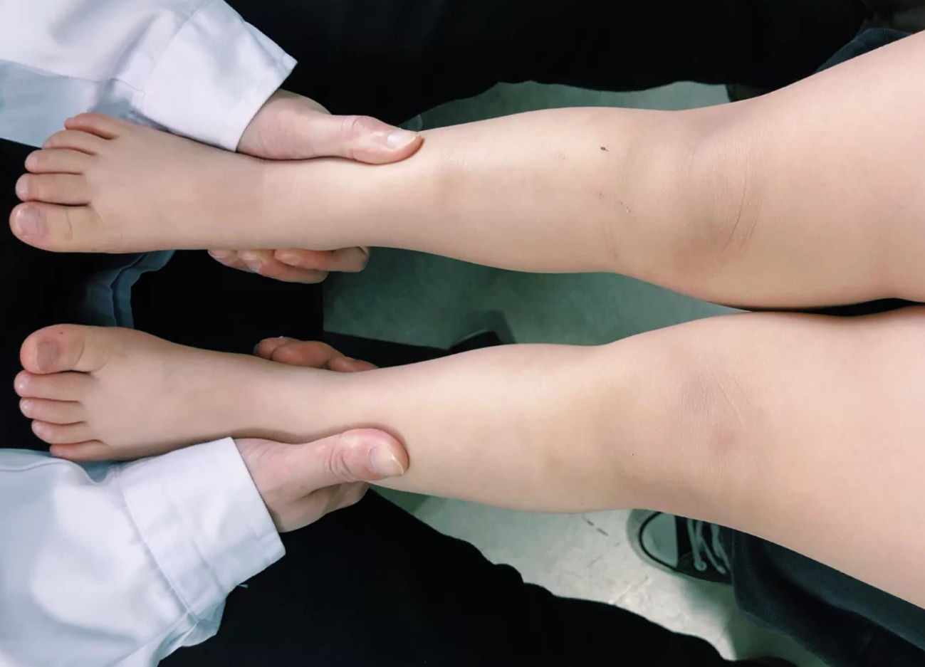 孩子能不能长高看哪里,如何判断孩子腿部发育