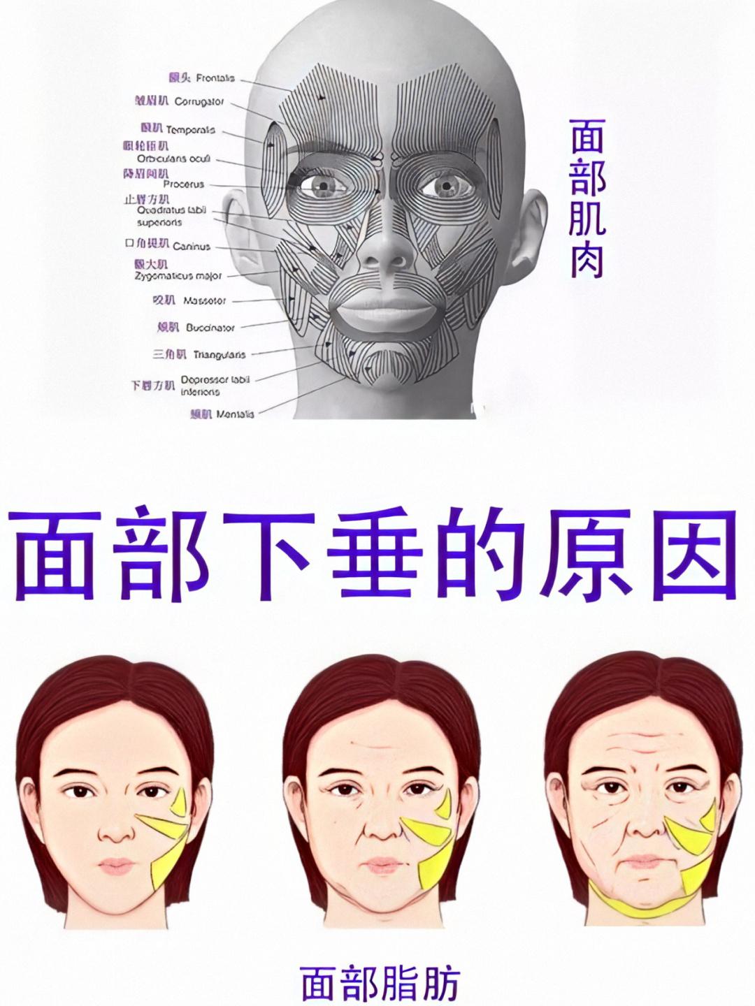 脸上皱纹多皮肤松弛怎么办问医生,皱纹多皮肤松弛做拉皮需要多少钱