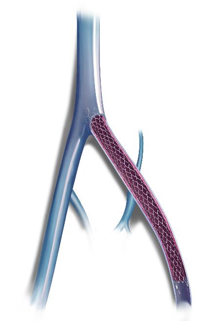 【科普创新月】“老烂腿”，我们应该怎么办？