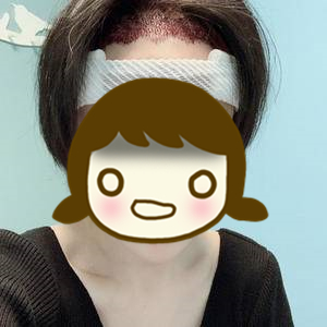 发际线太高怎么办初中生,发际线太高怎么办学生党