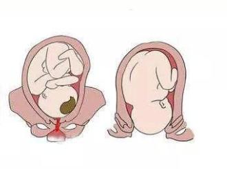 临产时怎么检查宫口开几指了,什么叫开宫口