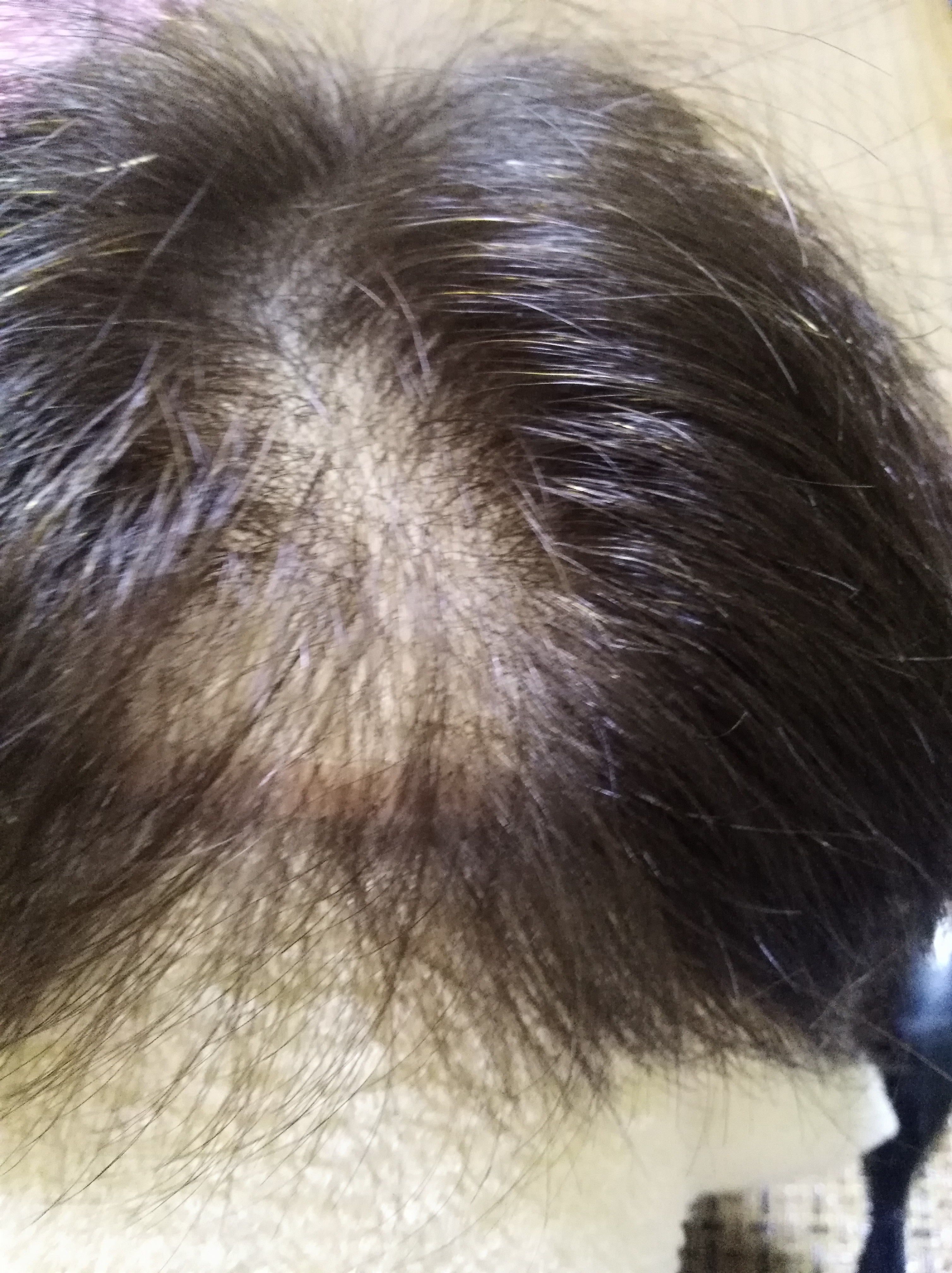 假发揭秘,假发内幕