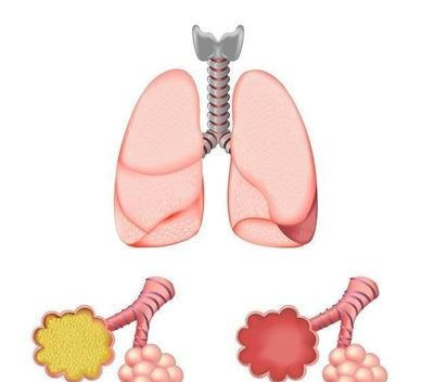 咳嗽不止胸闷气短,咳嗽不止总感觉有痰咳不出来