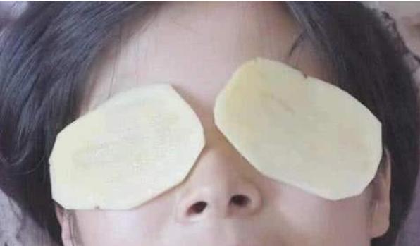 黑眼圈重有细纹怎样遮黑眼圈,有浓厚的黑眼圈该怎么淡化黑眼圈