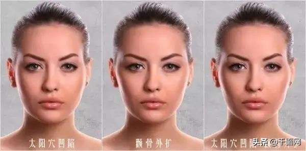 40多岁太阳穴凹陷填充,太阳穴凹陷填充分享