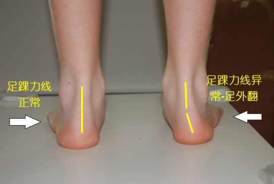 买跑鞋尺码合适就付款？按照这七个步骤你就是选鞋专家