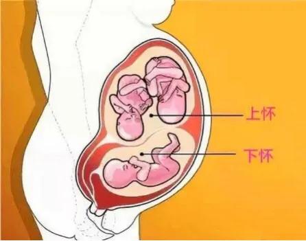 胎位上怀和下怀会变吗,怀孕下怀和上怀胎位有什么区别吗