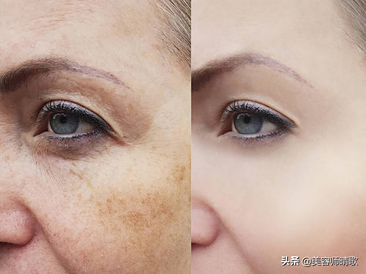 小白瓶淡斑精华推荐,淡斑小白瓶精华