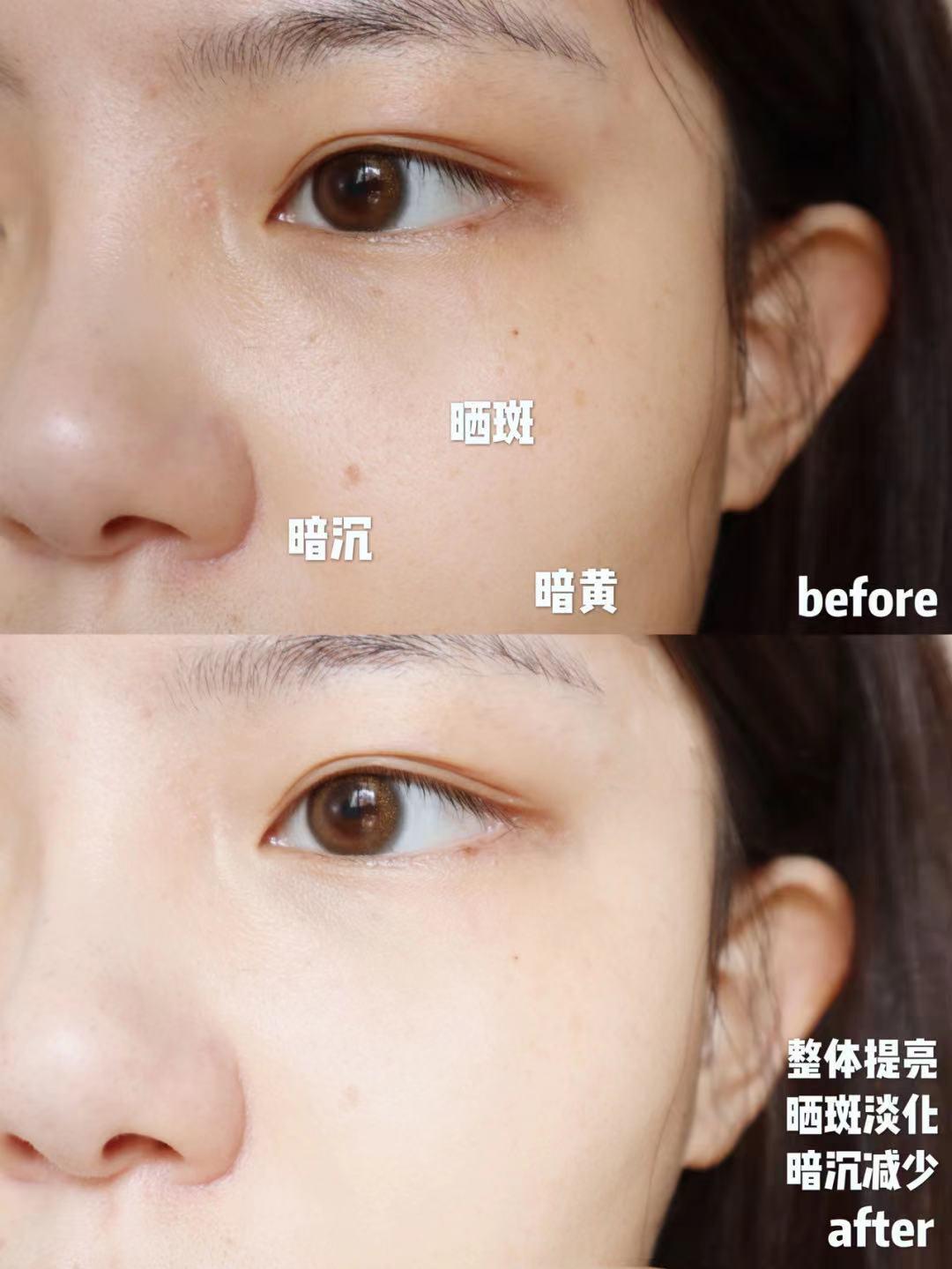 小灯泡与科颜氏淡斑测评,科颜氏去黄提亮效果怎么样
