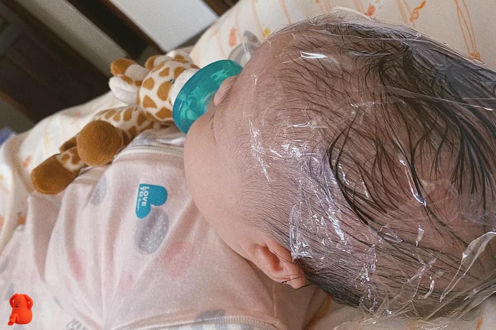 宝宝乳痂怎么去除,手贱扣痂会留印吗