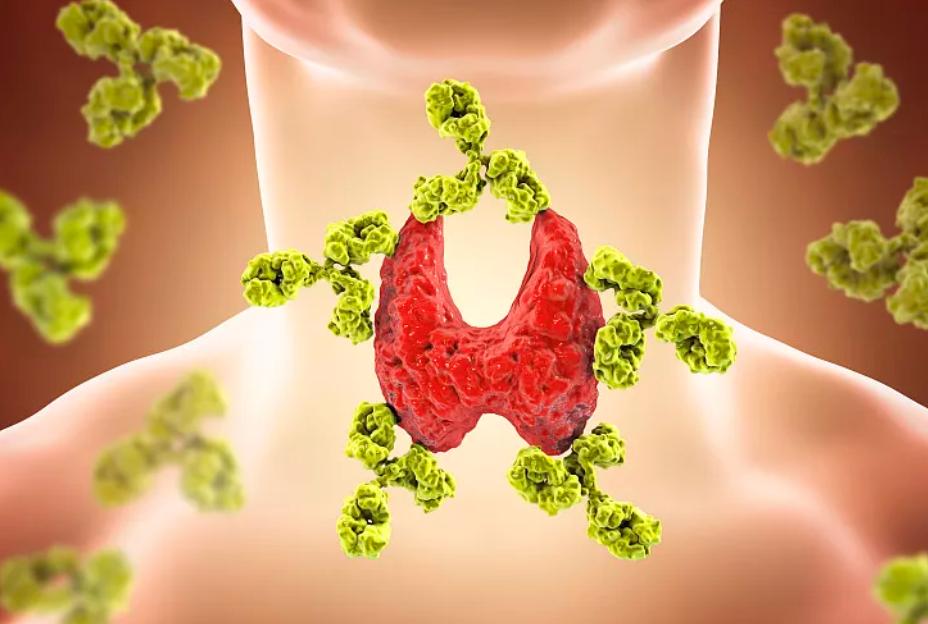湿疹水泡瘙痒中药外洗,湿疹有水泡有明显瘙痒