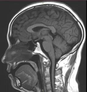 讲解医学影像的书,医学影像学几年