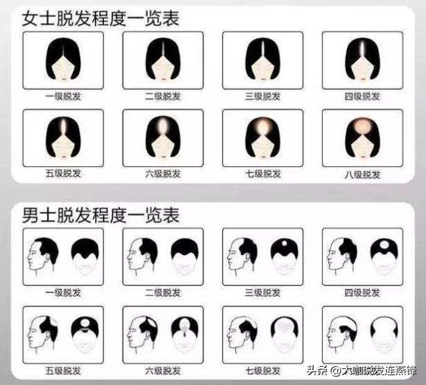 远离脱发的四个误区,脱发前的七大征兆