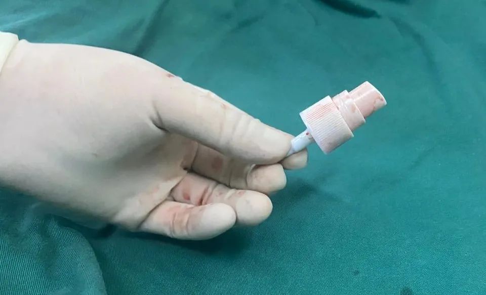 【呱呱教76】惊现!8岁女童体内竟藏有香水瓶喷头