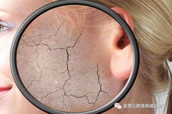 皮肤干燥怎么办女生,皮肤干燥怎么办用什么护肤品