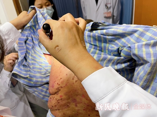 皮肤科死亡率最高的病,皮肤科致死性疾病