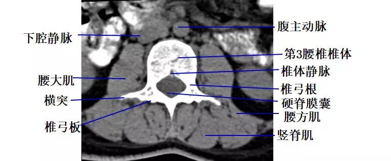 颈椎腰椎疾病ct及mri诊断,腰椎ct可以发现肠部病变吗