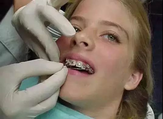 矫正牙齿垫高咬合难受怎么办,矫正牙齿第一天痛得厉害怎么办