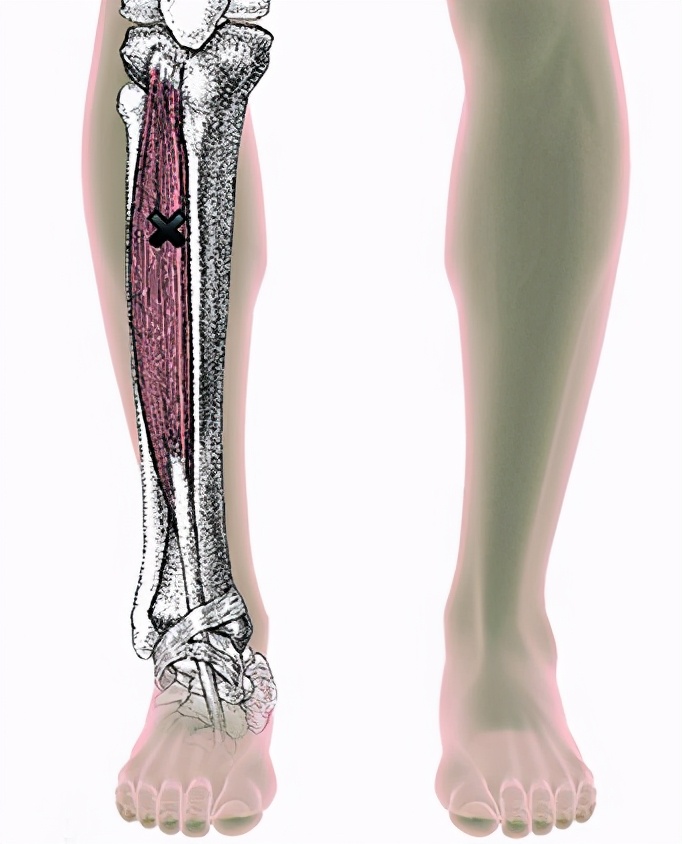 踝关节背屈和跖屈如何训练,三种改善踝关节背屈活动度的方法