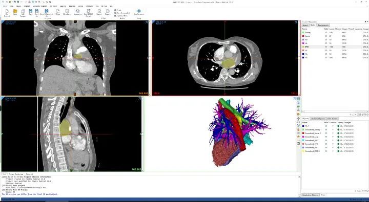 大学生如何选购笔记本电脑?(各大专业电脑推荐)
