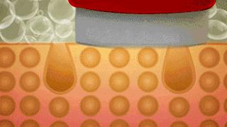 长期吃胶原蛋白保健有什么副作用,女人长期服用胶原蛋白会有皱纹吗